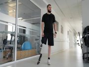 Біг, плавання, танці: спорт із протезом ноги &mdash; це реально